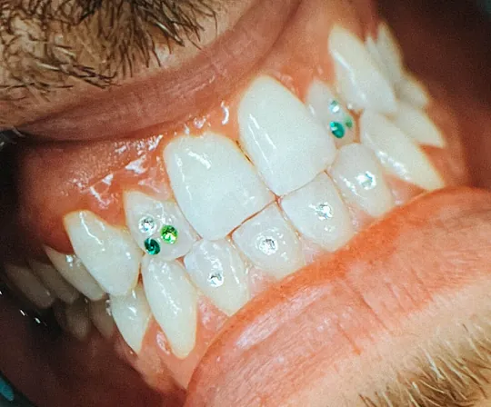 Siete Vidas Tattoo gema dental